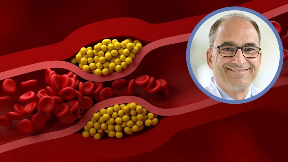 Neuer Cholesterin-Tiefstwert: So schützt er Ihr Herz