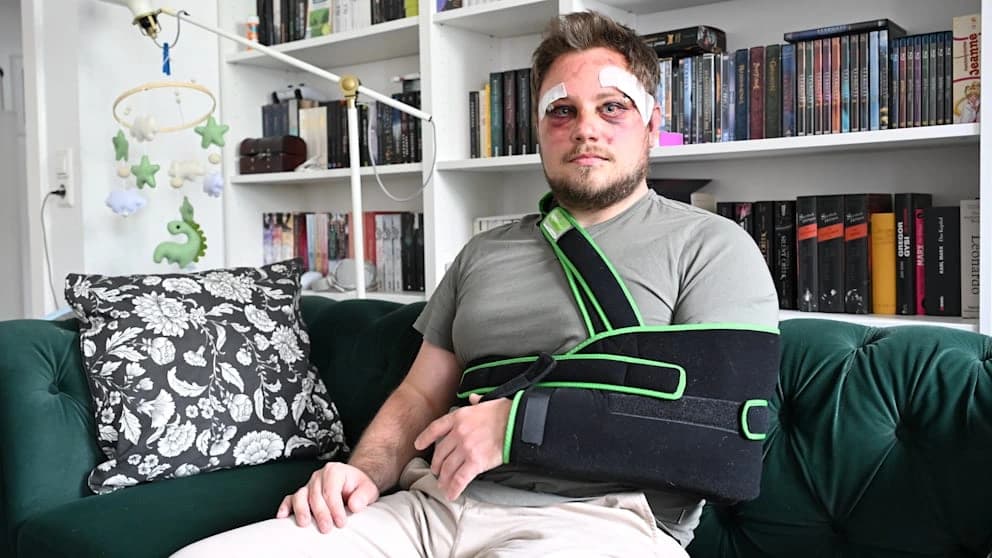 Platzwunden am Kopf, Hämatome im Gesicht und ein ausgekugelter Arm. Steven K. sitzt am Mittwoch in seiner Wohnung